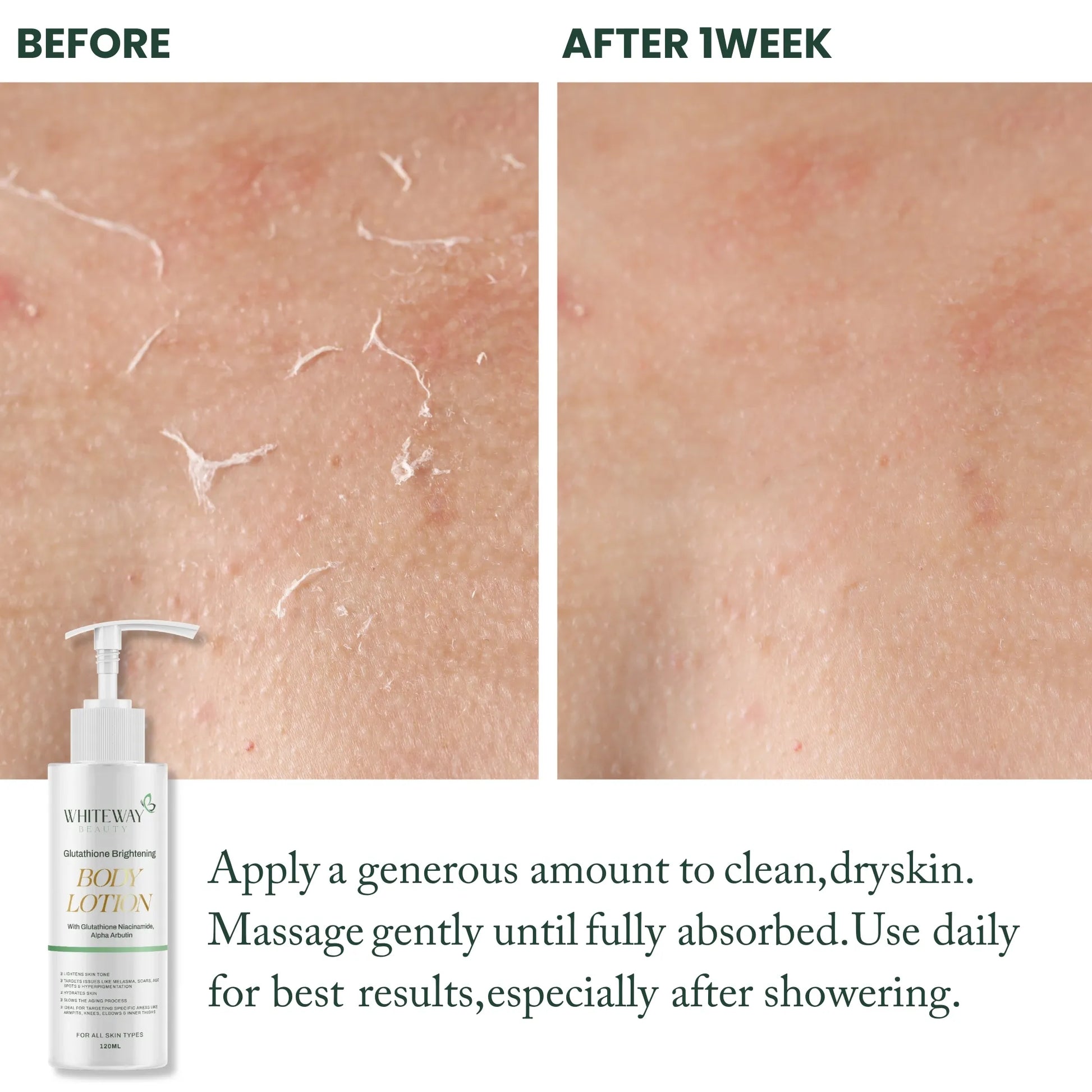 Before and after 1 week results of Whiteway Beauty Glutathione Brightening Body Lotion showing reduced skin flaking, smoother texture, and a more even skin tone.